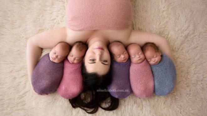 امرأة أسترالية نشرت صورتها مع توائمها الخمسة