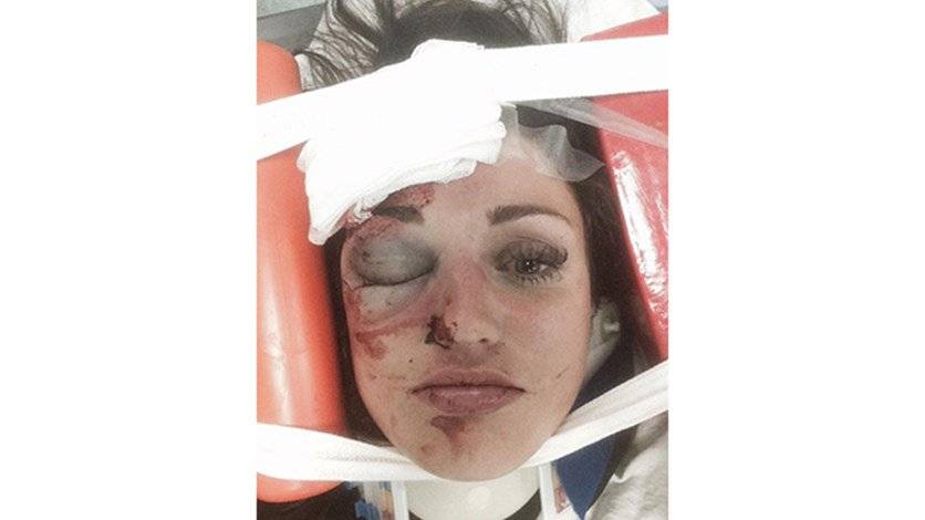 ضربها على وجهها بوحشية... والسبب غريب جداً!