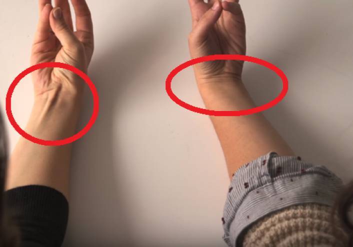 ما السبب وراء إنتفاخ الوريد في معصمك؟
