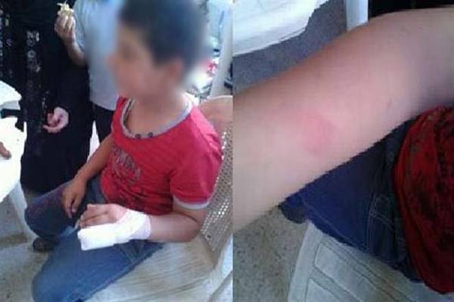معلمة في طرابلس ضربت أحد تلامذتها على يده ما تسبب بكسر إصبعه.. ولكن ما فعلته المدرسة كان مفاجئاً!