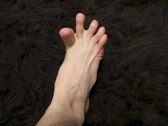 لهذا السبب تصابون بتشنجات مفاجئة في أقدامكم!!