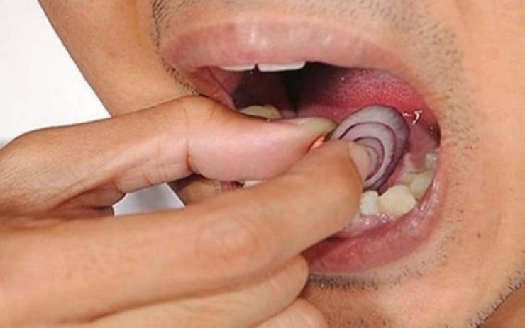 ماذا يحدث إذا وضعتم شريحة بصل على أسنانكم؟