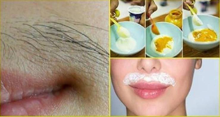 تخلّصي نهائيا من شعيرات الوجه المحرجة ...