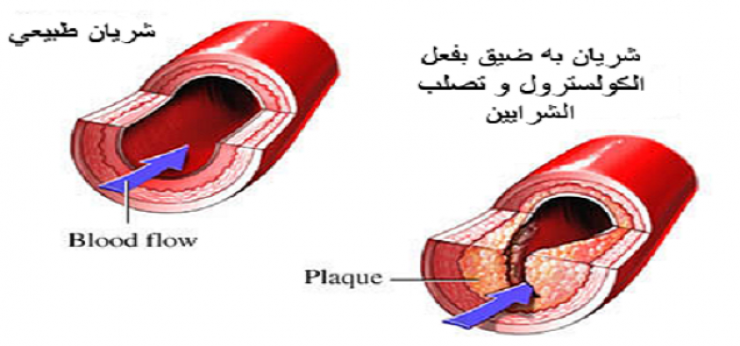 الفاكهة الوحيدة التي تقضي على الكوليستيرول الضّار!