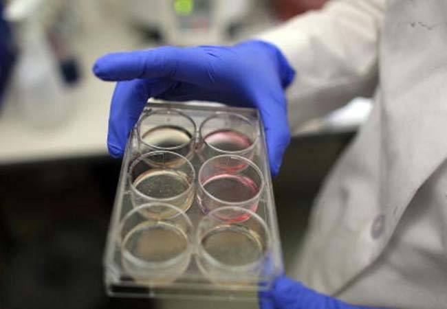 علاج التصلب اللويحي ينذر بأعراض جانبية خطيرة