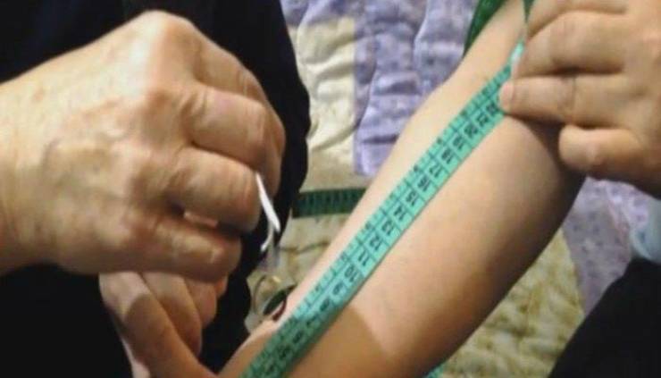 طريقة جديدة لقياس ضغط الدم : لن تحتاجوا إلا شريط قياس وحلقة !