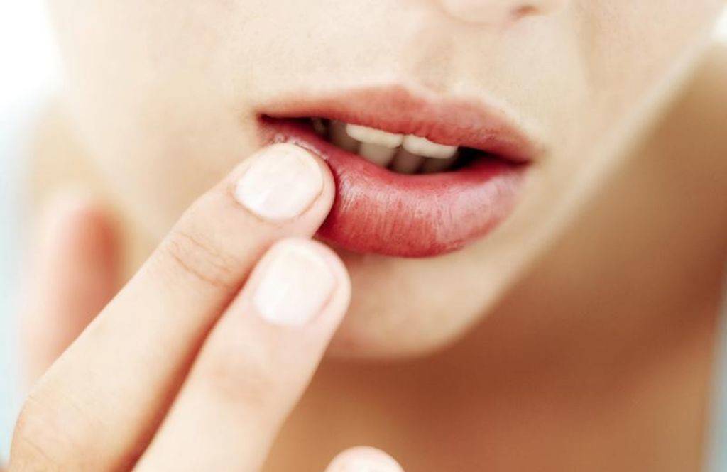 6 أشاء تخبركم بها الشفاه عن صحتكم!