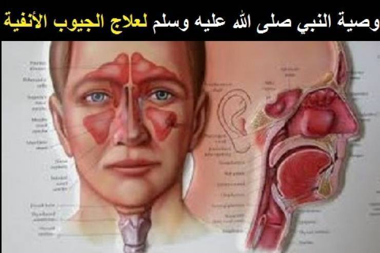 وصية النبي لعلاج الجيوب الأنفية