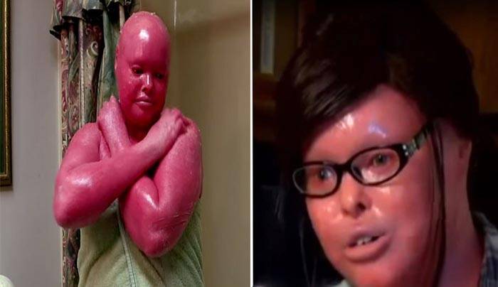 هذه المرأة ولدت مصابة بمرض نادر. لكنها حققت 3 معجزات في خلال 20 سنة!