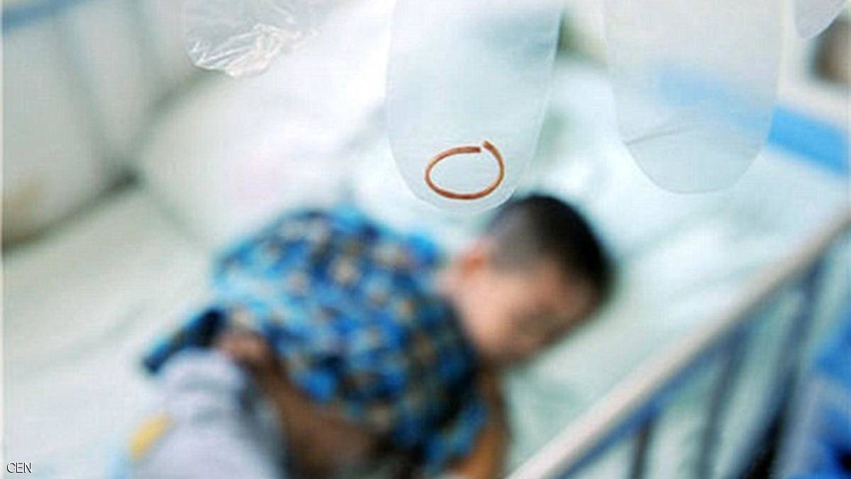 وضع سوارًا من الفضّة.. ولدى خلعه حصلت الكارثة!