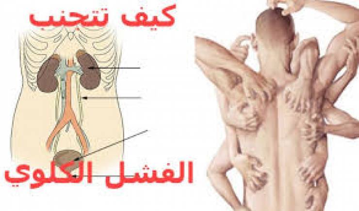 علامات إذا رأيتها على جسدك فأنها تشير بأصابتك بالفشل الكلوي!