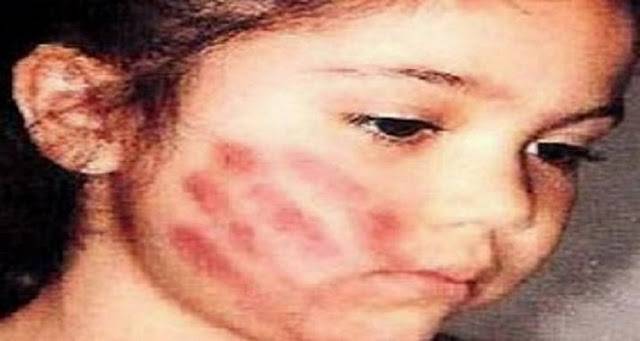 لماذا نهى الرسول صلعم عن الضرب علي الوجه؟