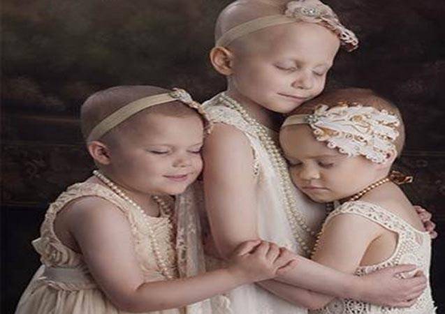 دخلت صورة الطفلات الثلاث المصابات بالسرطان كل القلوب. لكن بعد سنتين، شاهدوا الصدمة!