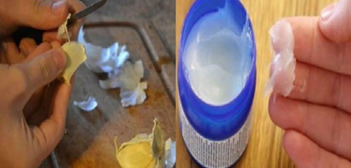 ضعوا قليلاً من مرهم Vicks على فص ثوم... لن تصدقوا النتيجة !