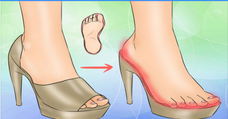 لماذا يعتبر الكعب العالى  خطيرا على الفتيات قبل الزواج ؟