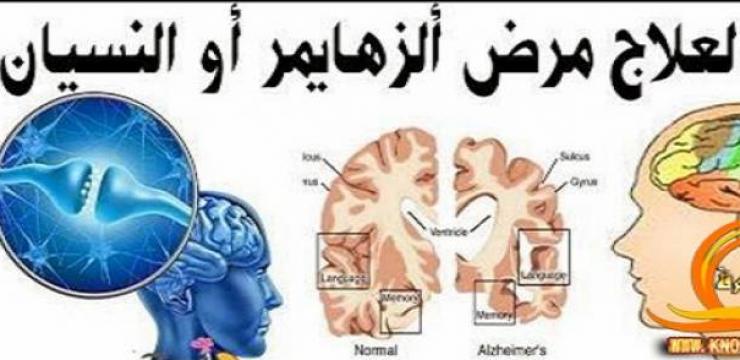 سورة في القرآن تقضي على مشكلة النسيان والزهايمر !