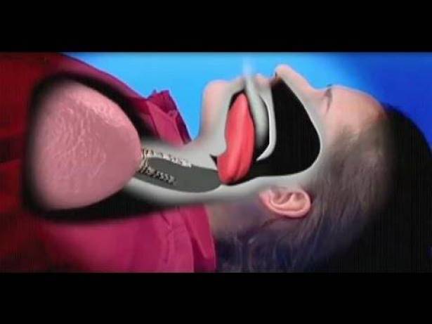 بالفيديو: كيف تنقذ شخصاً من الموت في حال 