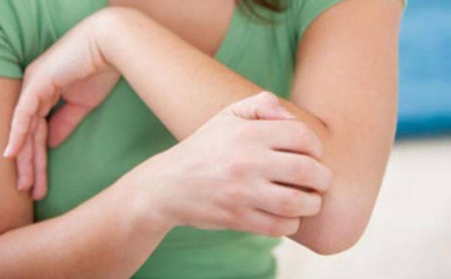 5 حيل طبيعية لإبعاد لسعات البعوض نهائياً