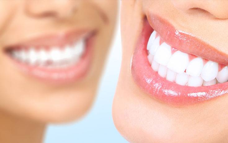 خلطة طبيعية للحصول على أسنان بيضاء كالثلج