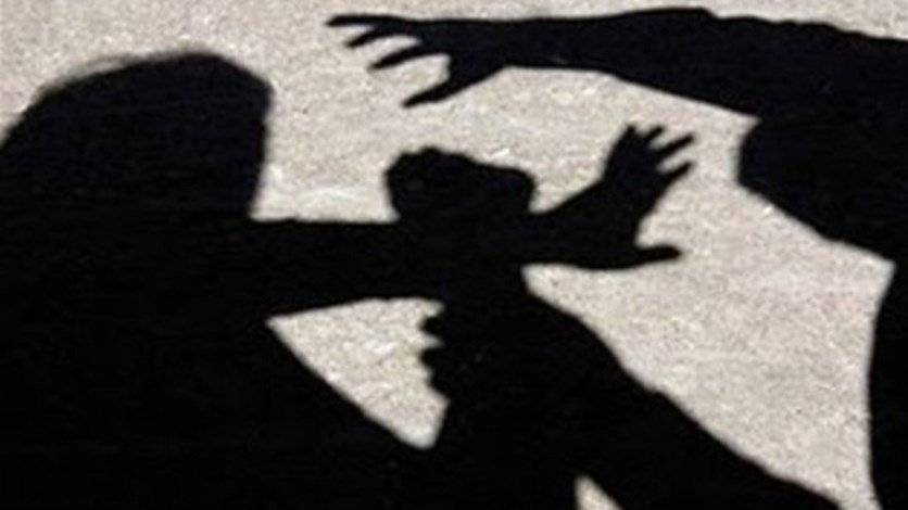 حرقوه بالحديد الساخن... والسبب 100 دولار!