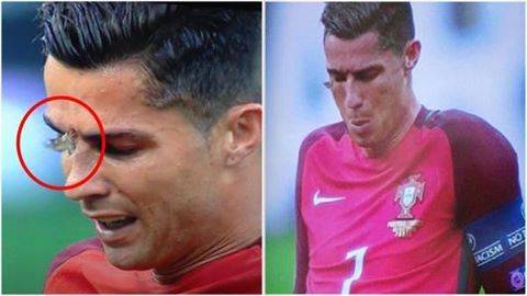 بالصور ما سر صورة رونالدو والفراشة ؟