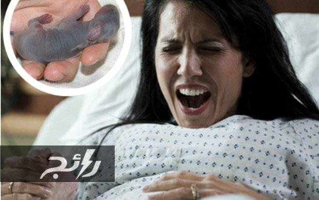 صادم : المرأة التي انجبت “أرنبًا”… لن تصدّقوا كيف حصل ذلك!…