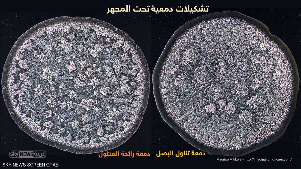 بالانفوغرافيك.. حقائق لا تعرفها عن الدموع !