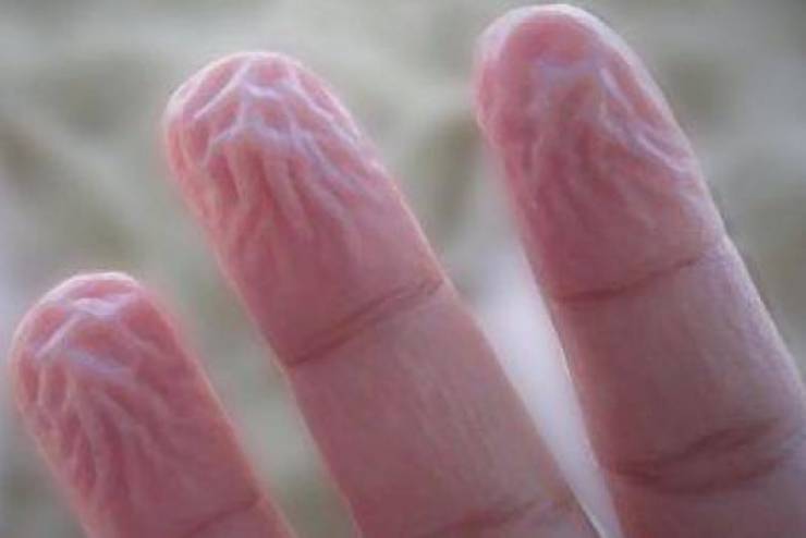 سبب عجيب وراء تجاعيد اليدين التي تظهر في الماء.. ما هو؟