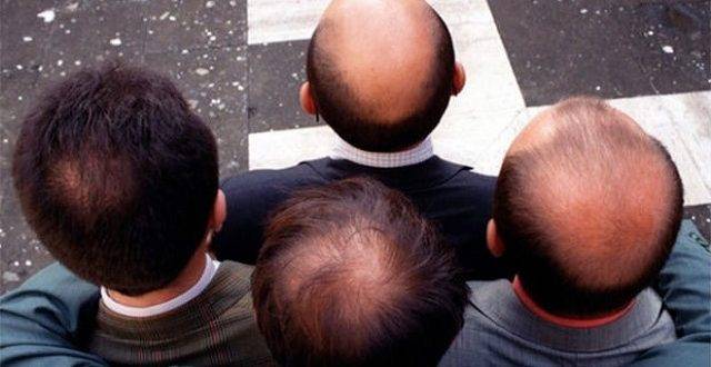 بعد 73 عاما خبرة.. حلاق يكشف أغرب طريقة لوقف تساقط الشعر الى الأبد!