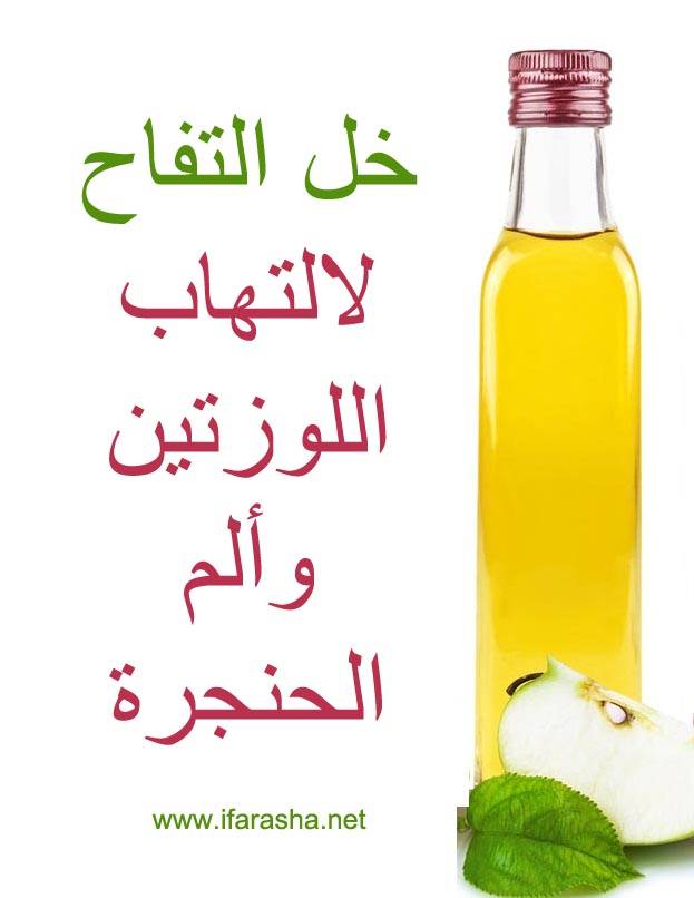 خل التفاح لالتهاب اللوزتين وألم الحنجرة
