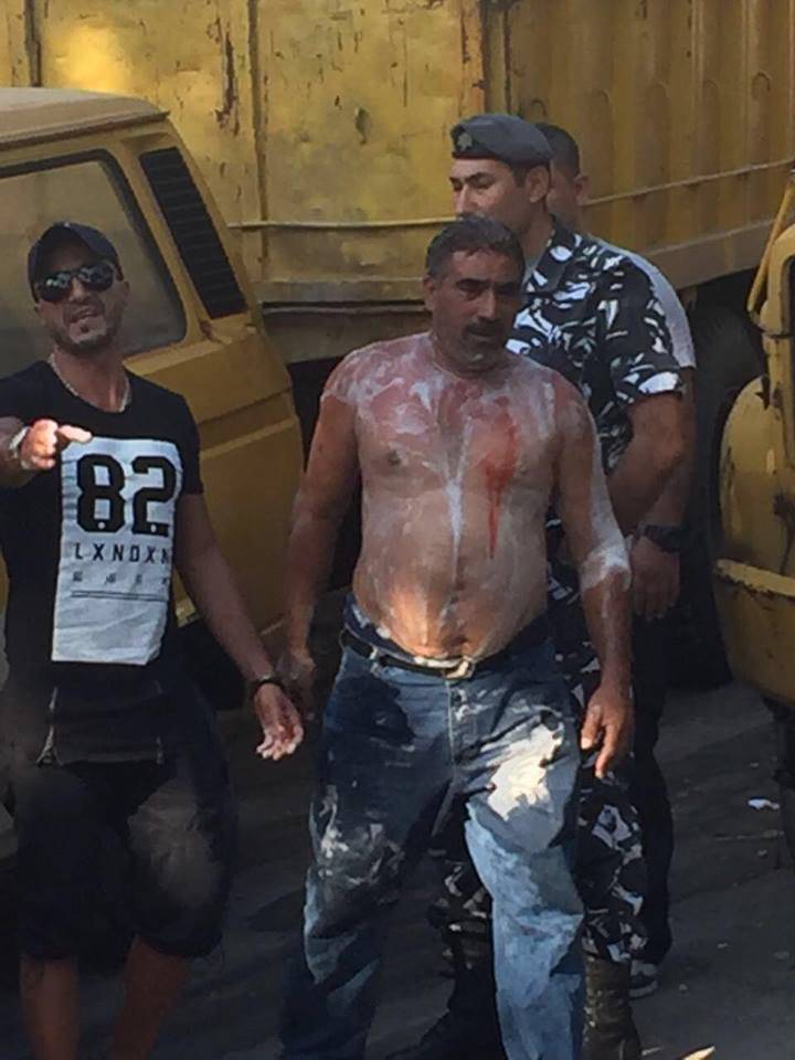 بالصورة- المياوم عامر موسى بعد محاولته احراق نفسة على المدخل البحري لمؤسسة كهرباء لبنان (LBCI)