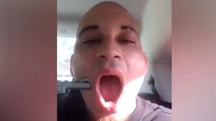 بالصورة: أطلق النار على نفسه... في سبيل الشهرة!