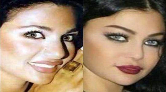 بالصور – حساب على انستغرام يفضح عمليات تجميل النجوم
