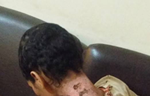 بالصورة.. زوجة أب تجرّدت من الإنسانية وهذا ما فعلته