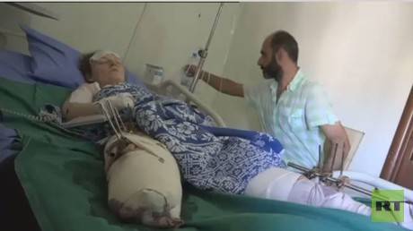 بالفيديو: روسية فقدت ساقها ويدها في حلب: المهم أنني أنقذت أطفالي!
