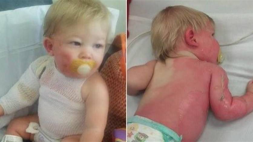 خرطوم مياه يتسبّب بحرق طفل... اليكم الرواية الكامل