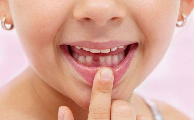 إنسي جنية الأسنان! هذا ما عليك فعله بأسنان طفلك بعد سقوطها