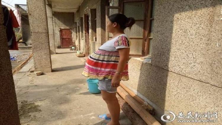 حالة نادرة.. حملت 17 شهراً والنتيجة؟
