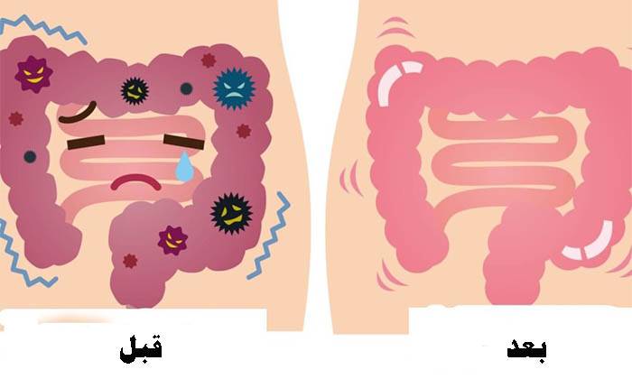هذا العلاج المؤلّف من مكوّنَين فقط سيجعلكم تتخلصون من الفضلات والسموم في القولون