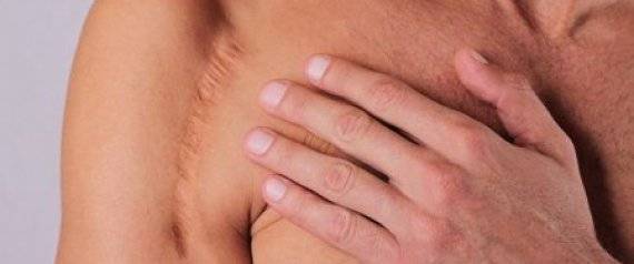 هل يمكن التخلّص من الندوب بشكلٍ نهائي؟؟