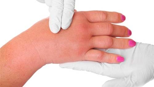 الجلد بحاجة للاحتفاظ ببعض البكتيريا للدفاع عن نفسه
