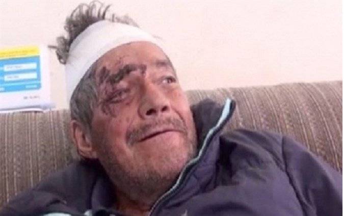 بعد شهرين من وفاته.. عائلة تُفاجأ بعودته الى الحياة!