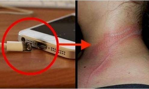 قصص كارثية.. إذا عرفتها لن تستخدم الهاتف أثناء شحنه
