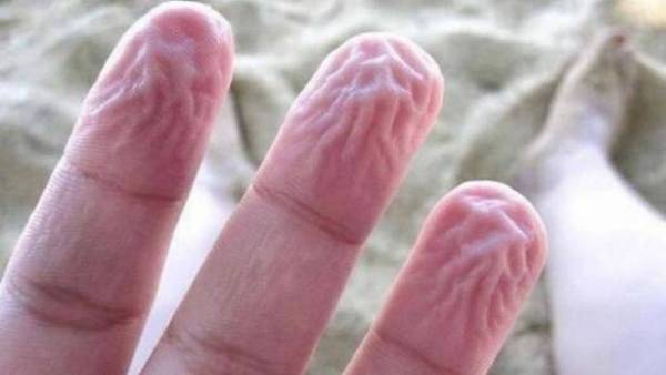 هذا السبب العجيب وراء تجاعيد اليدين التي تظهر في الماء!