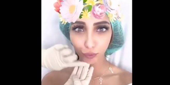 بالفيديو.. هكذا تحقن نجمة 