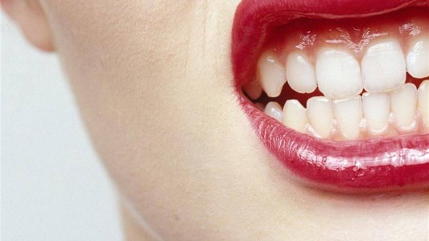 مادّة تزيل الصدأ قد تساعد في علاج الأسنان الحسّاسة!
