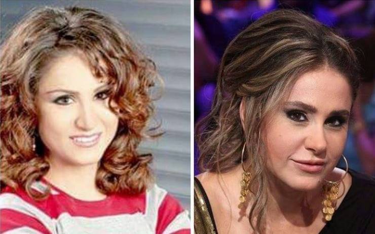 بالصور: هكذا أصبحت النجمات السوريات بعد التجميل!