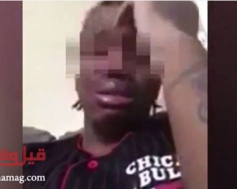 بالفيديو- شاب يشعل 