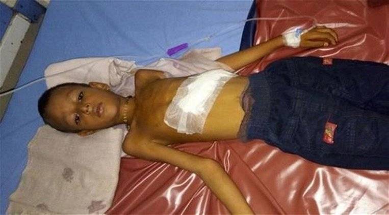 على مدى سبعة أشهر، اشتكى من آلام حادة في المعدة.. ما عُثِر عليه داخل بطنه مفاجأة تخطّت المعقول!