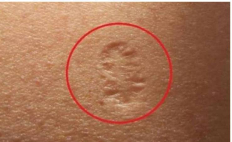 هذا هوسبب وجود علامة في الكتف الأيسر لمعظم الناس!!